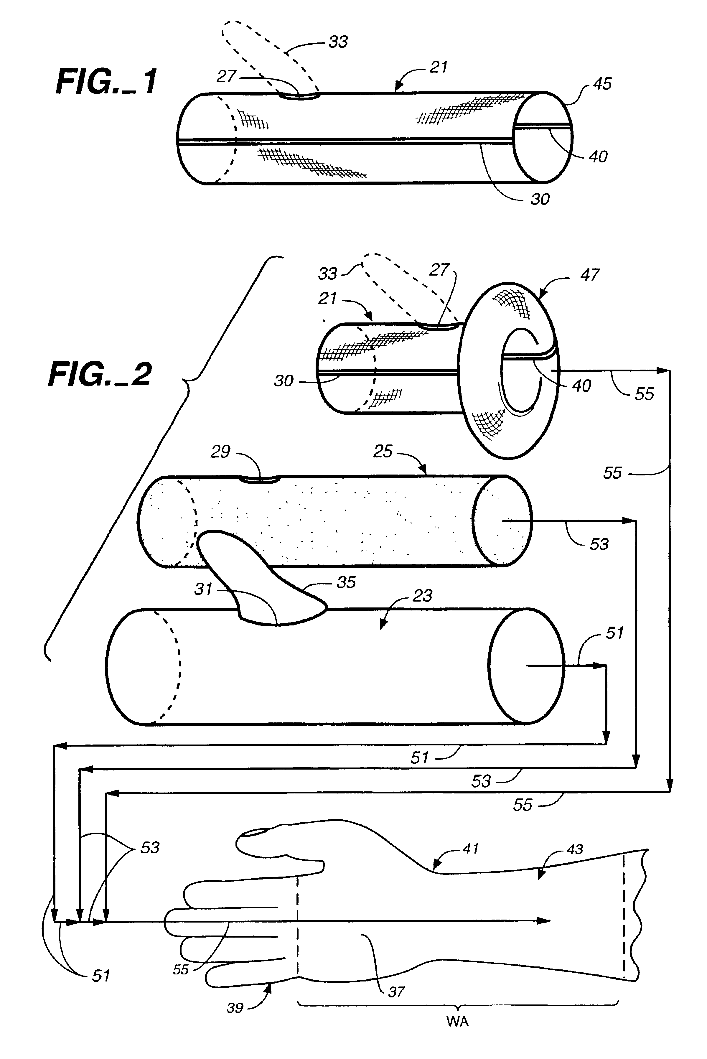 Custom molded wrist area impression kit and method