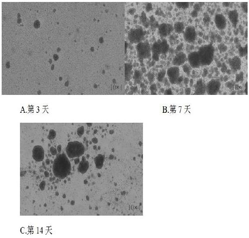 Method for in vitro multiplication culture of NK cells