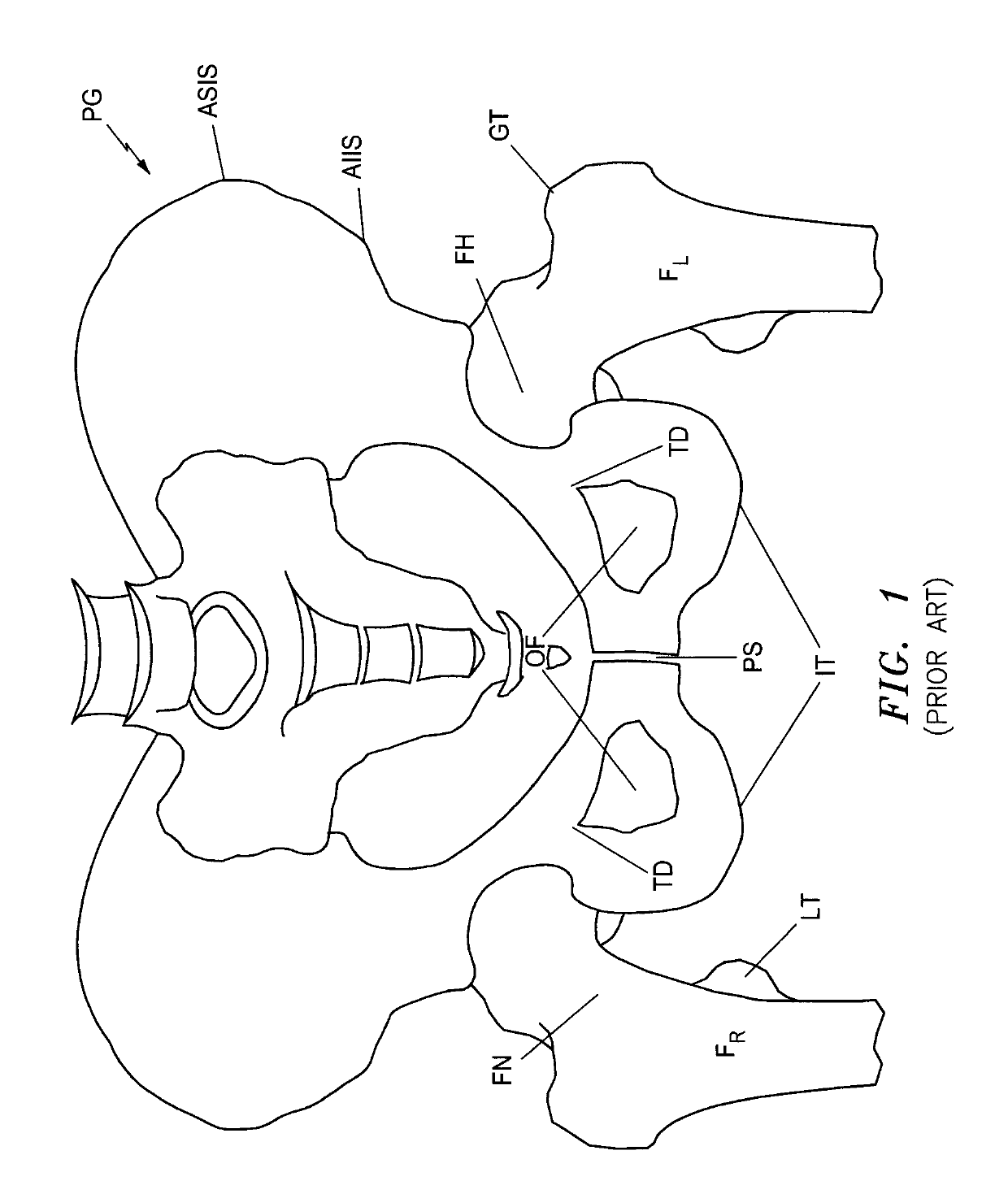 Systems and methods for intra-operative image analysis