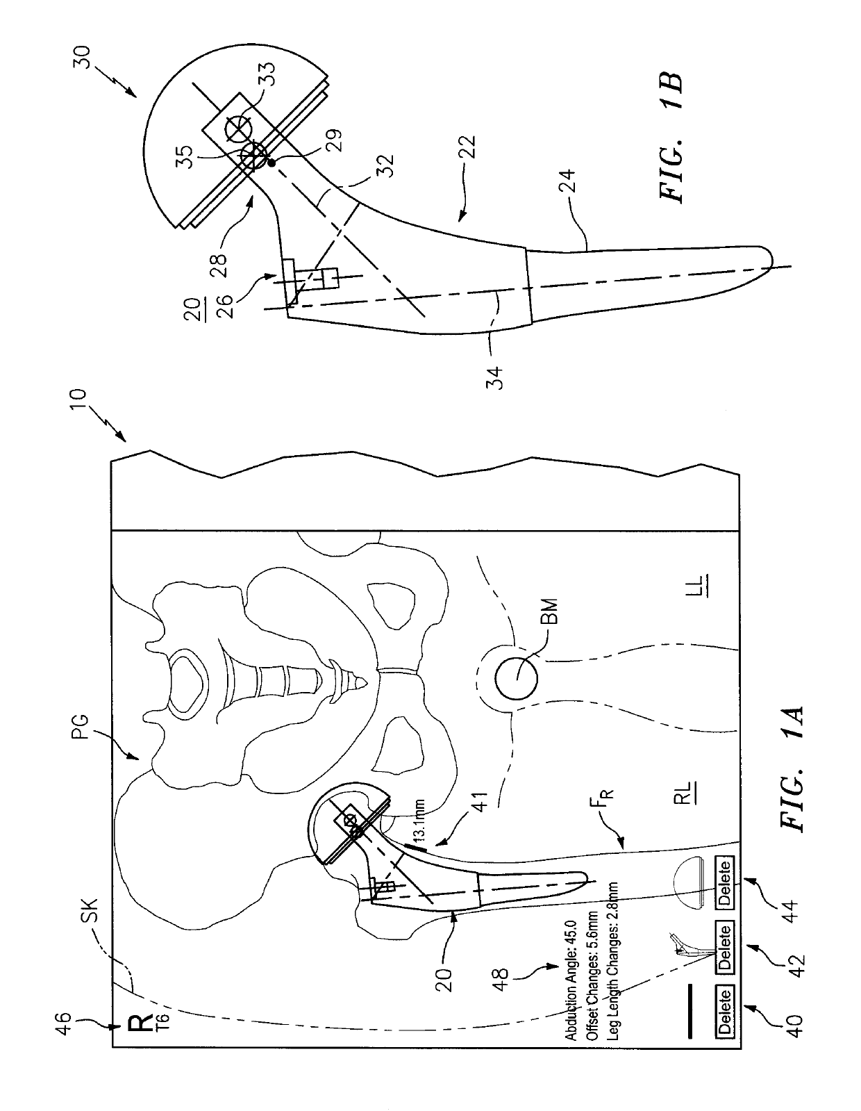 Systems and methods for intra-operative image analysis