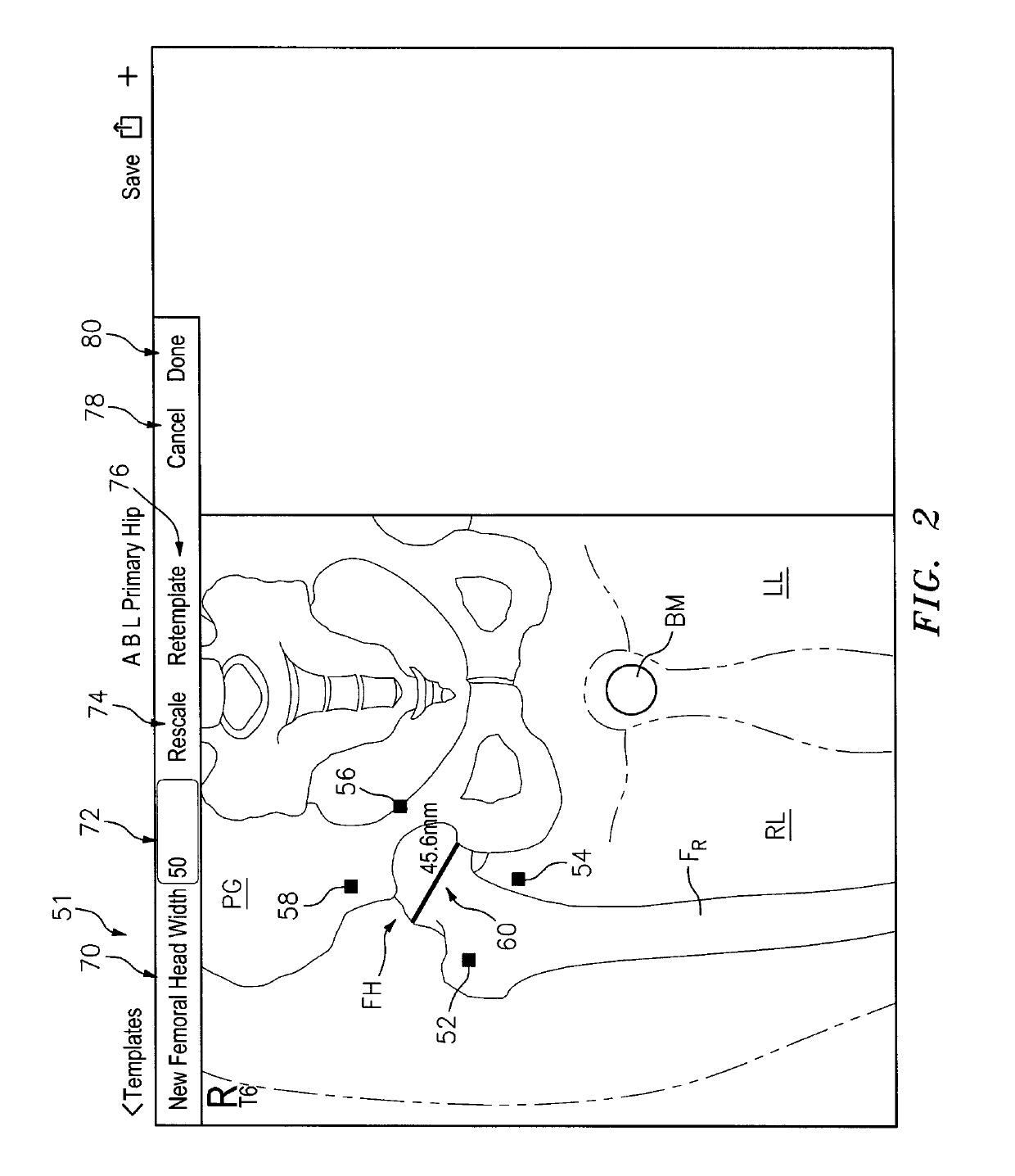 Systems and methods for intra-operative image analysis