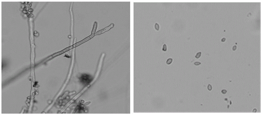 Cladosporium cladosporioides and application thereof