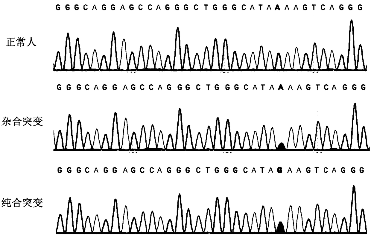 sgRNA editing HBB-28 mutation site based on CRISPR/Cas9 technology, vector and application thereof