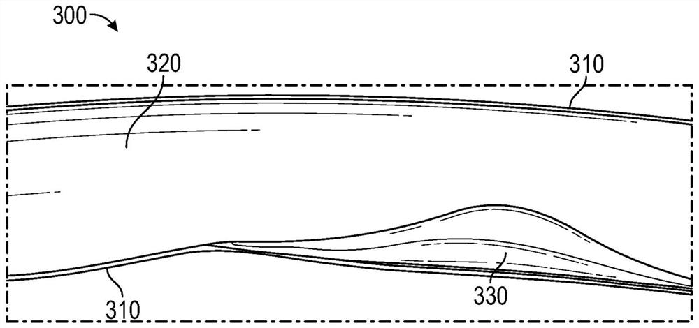 Speed determination for intraluminal ultrasound imaging and associated devices, systems, and methods