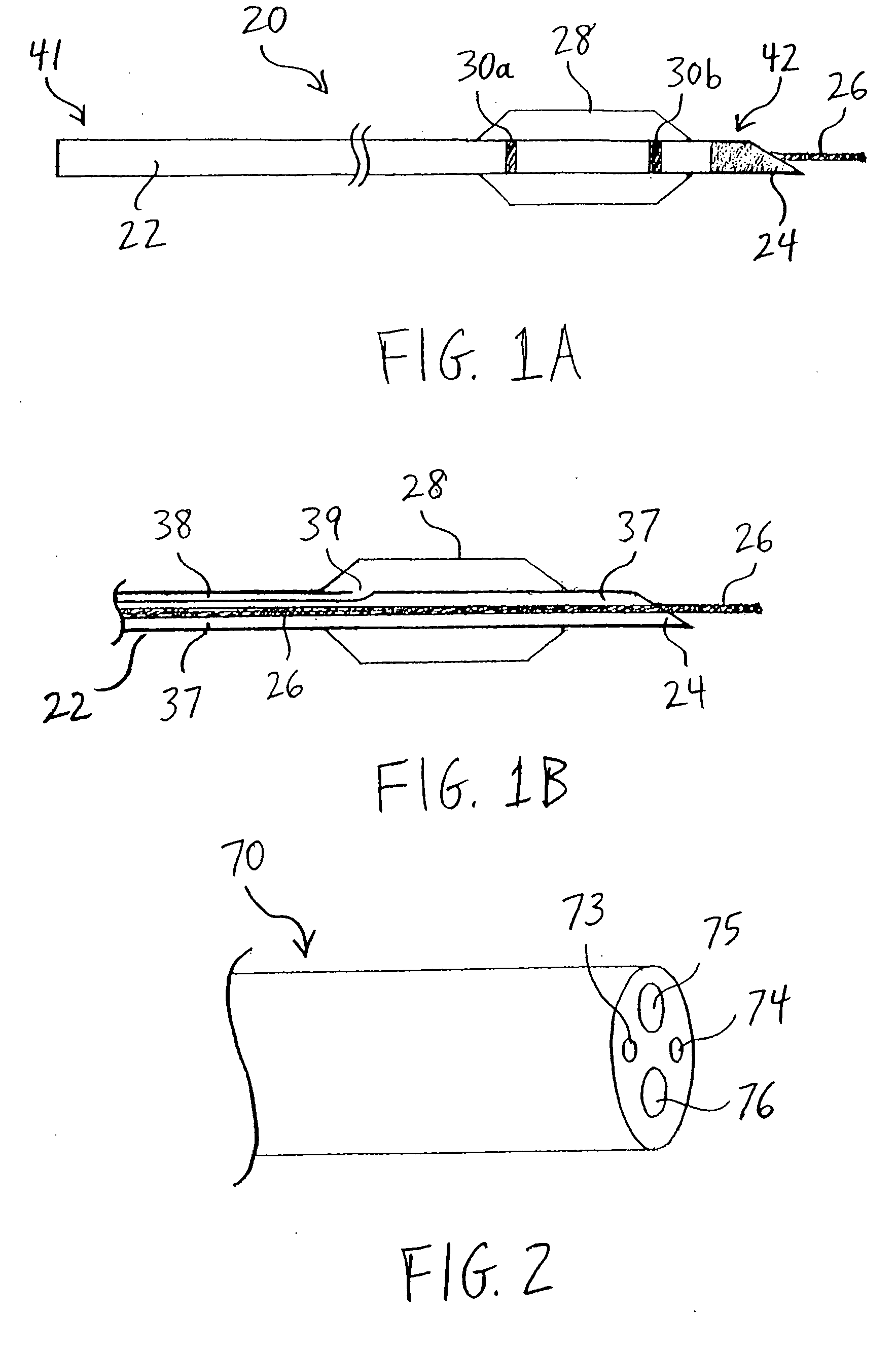 Apparatus and methods for endoscopic resection of tissue