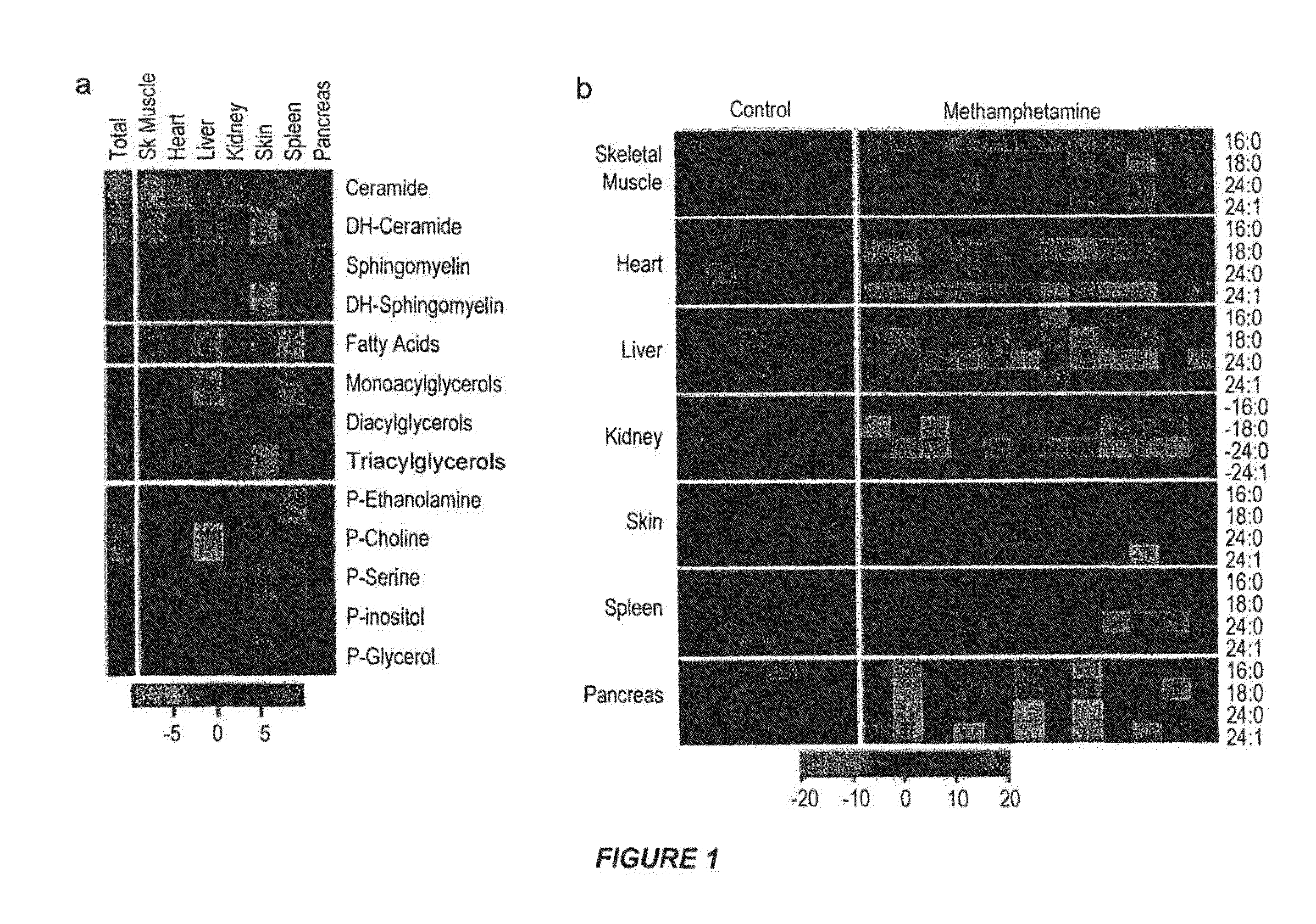 Methods of treatment, diagnosis and monitoring for methamphetamine toxicity which target ceramide metabolic pathways and cellular senescence