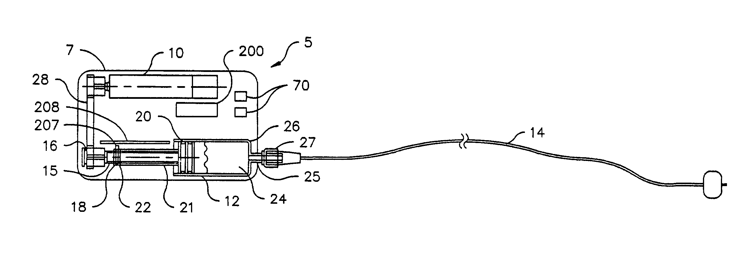 Infusion pump with a sealed drive mechanism and improved method of occlusion detection