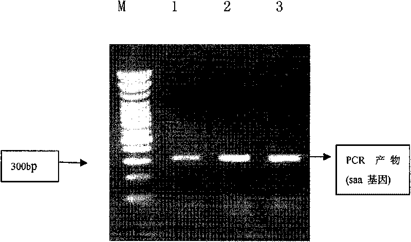 Method for preparing human serum amyloid A1 and expression vector and genetic engineering bacteria thereof