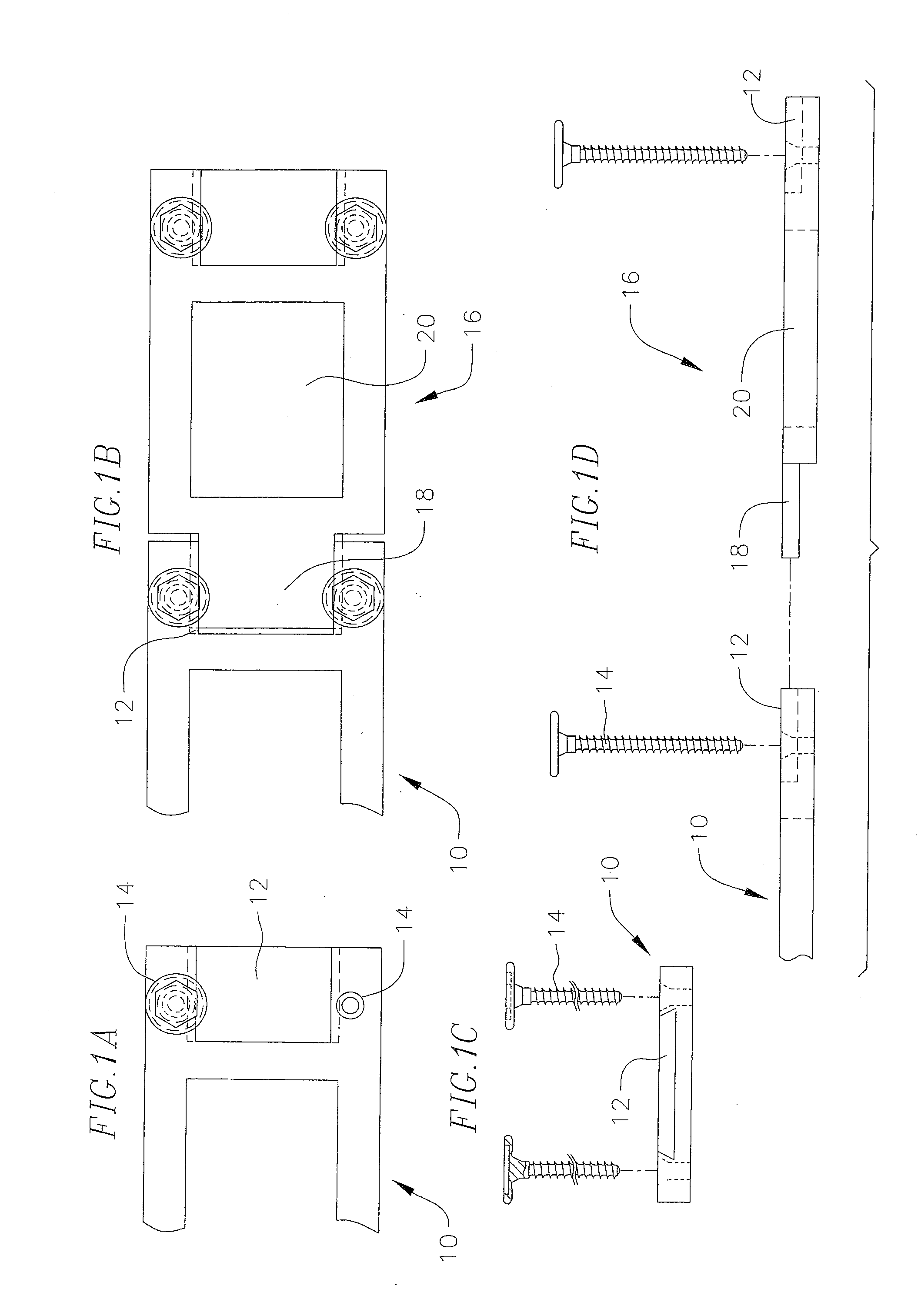 Distraction device for use with a revisable anterior cervical plating system