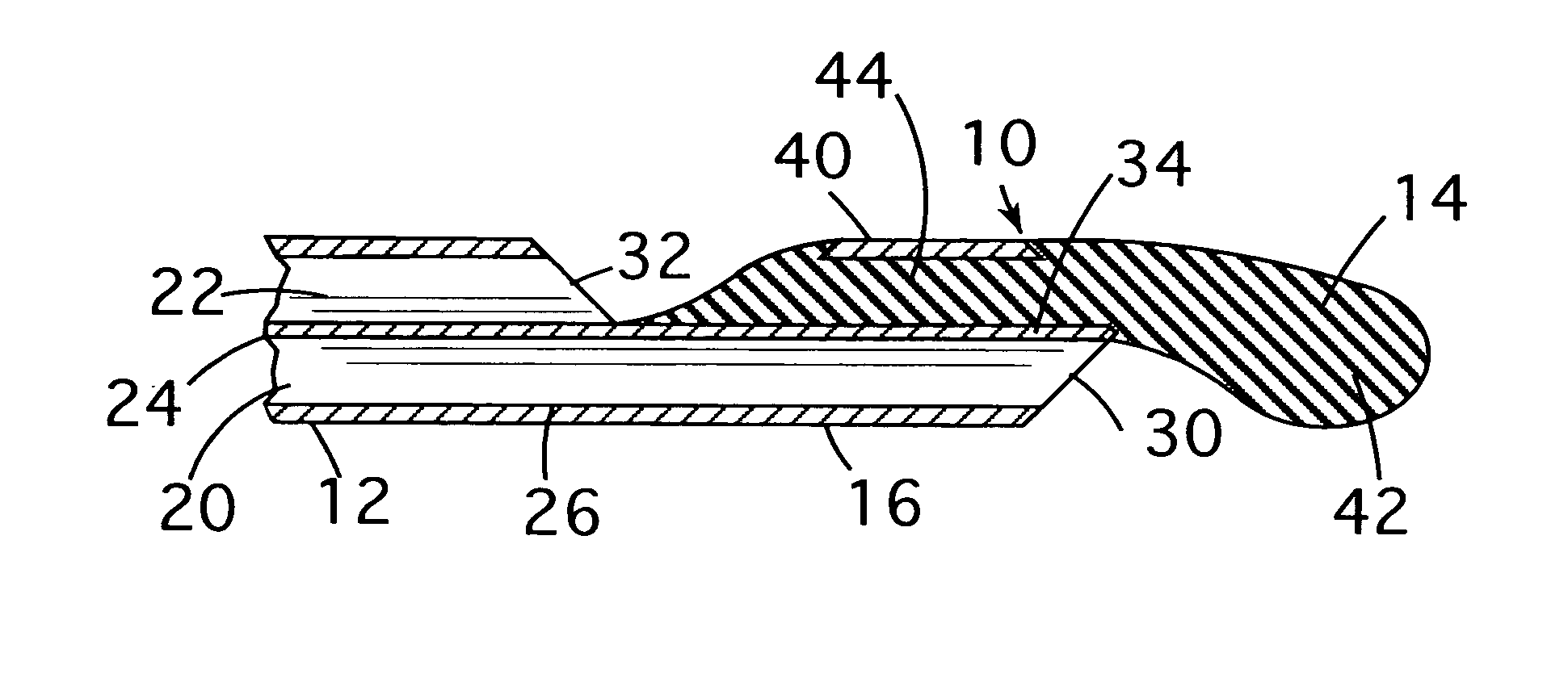 Catheter and method of manufacture