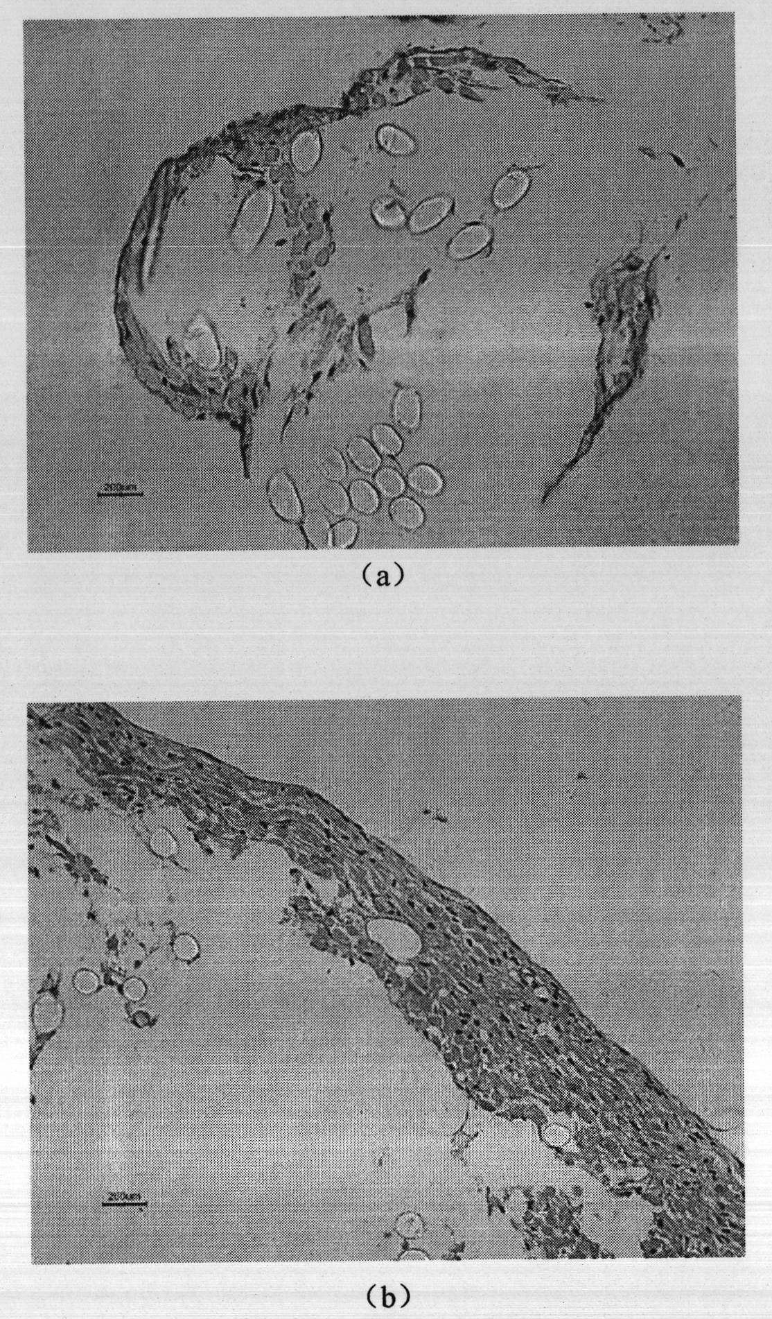 Tissue engineering artificial tendon scaffold enhanced body and preparation method thereof