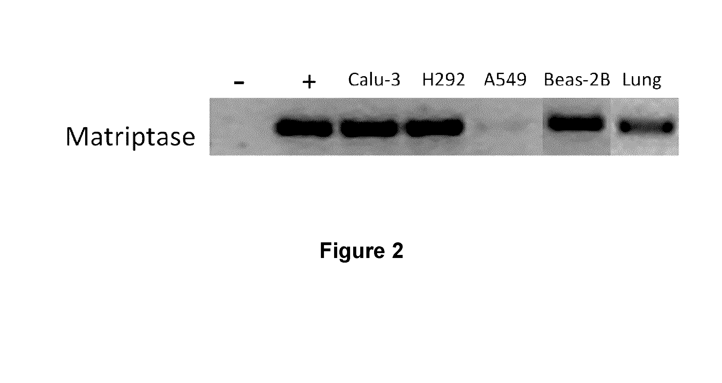 Matriptase inhibitors and uses thereof against orthomyxoviridae infections