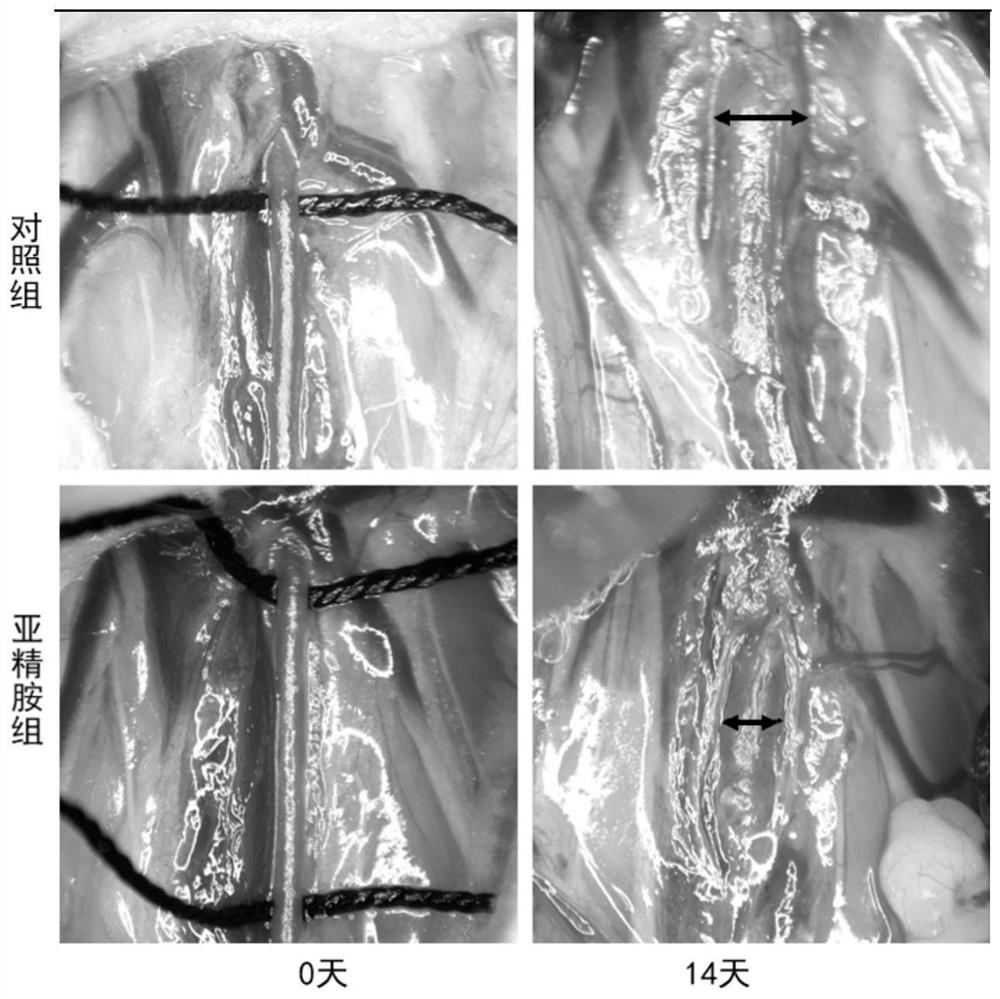 Application of spermidine in preparation of medicine for treating aortic aneurysm