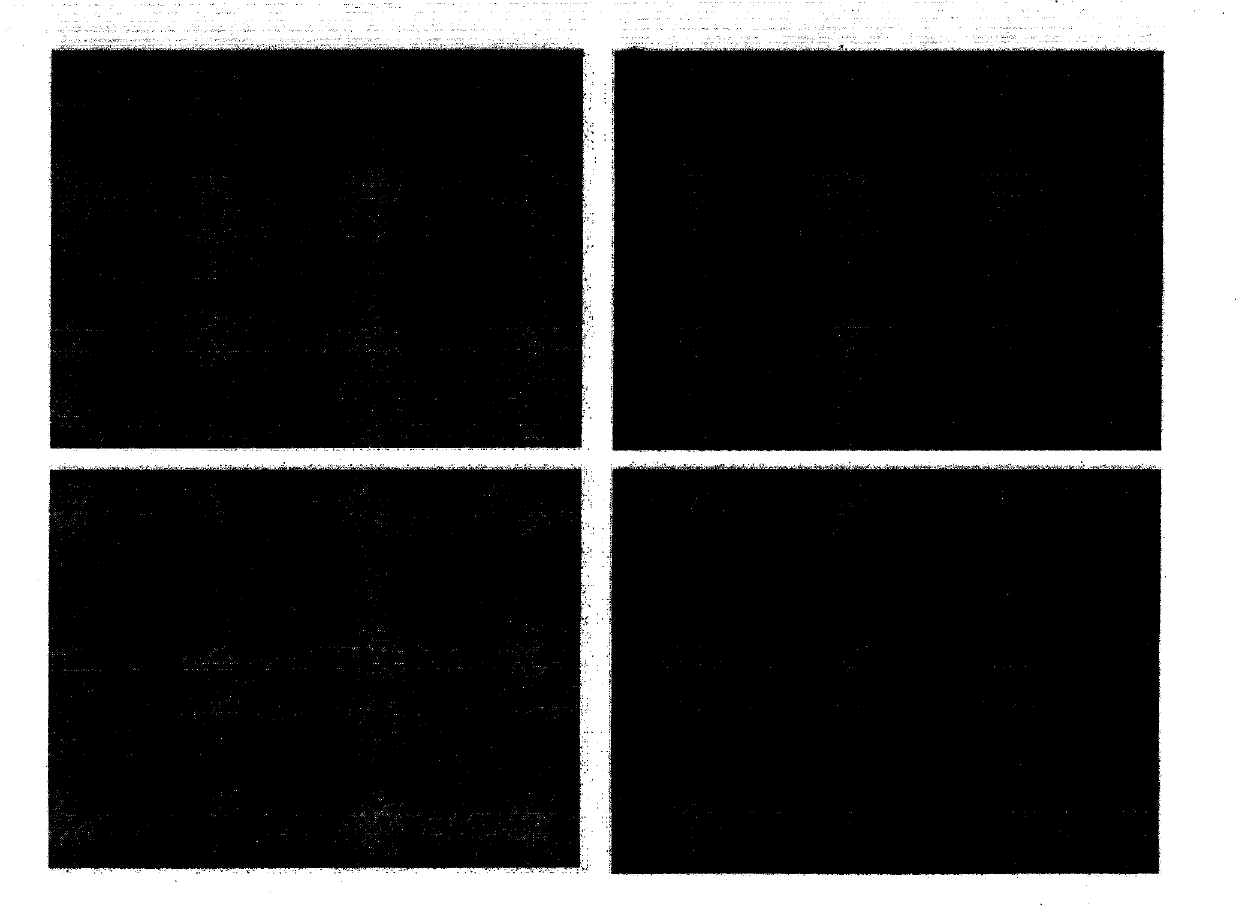 Cell culture composition used for primary culture of tumor cells and application thereof