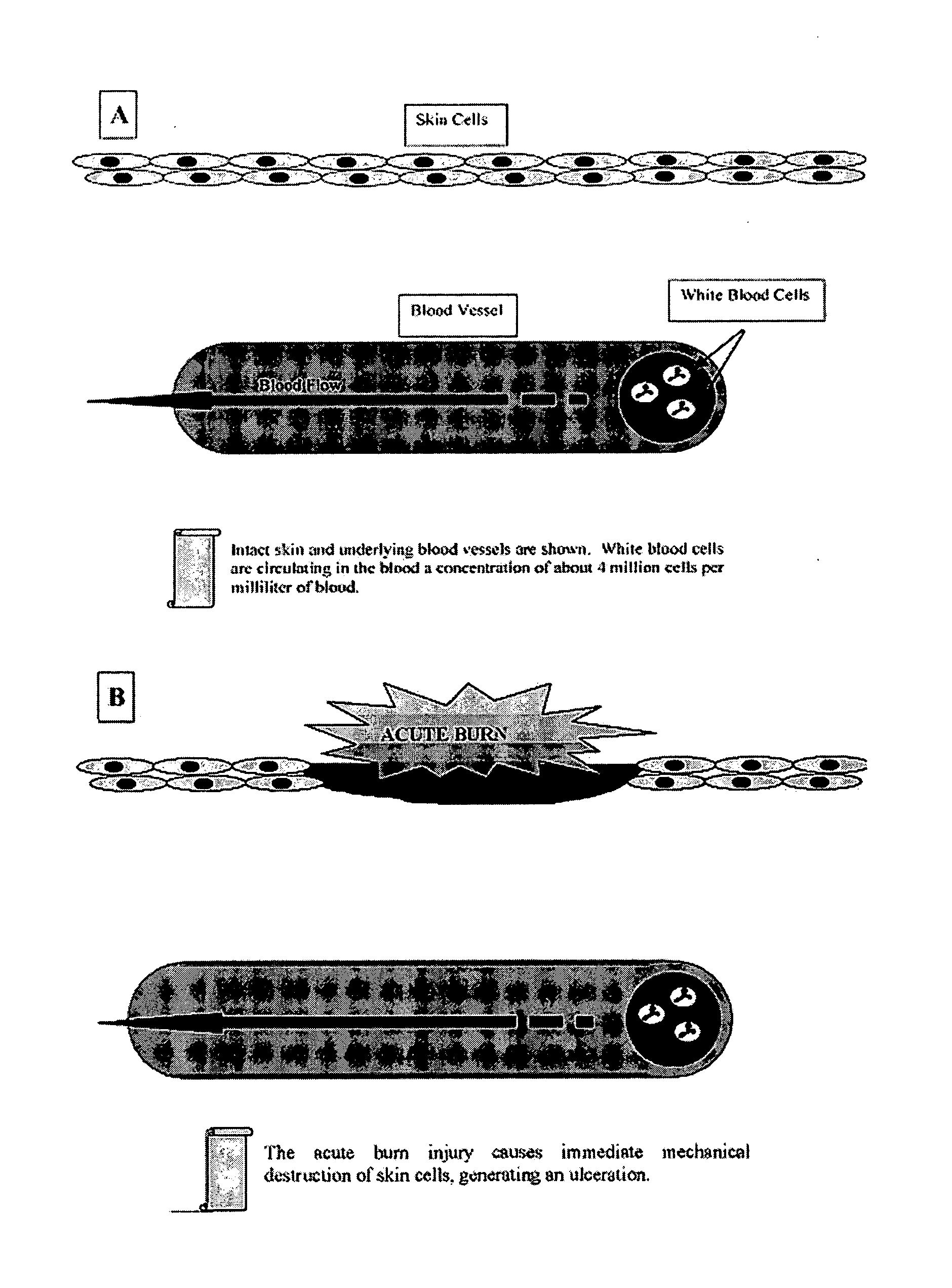 Compositions and methods for treating burns