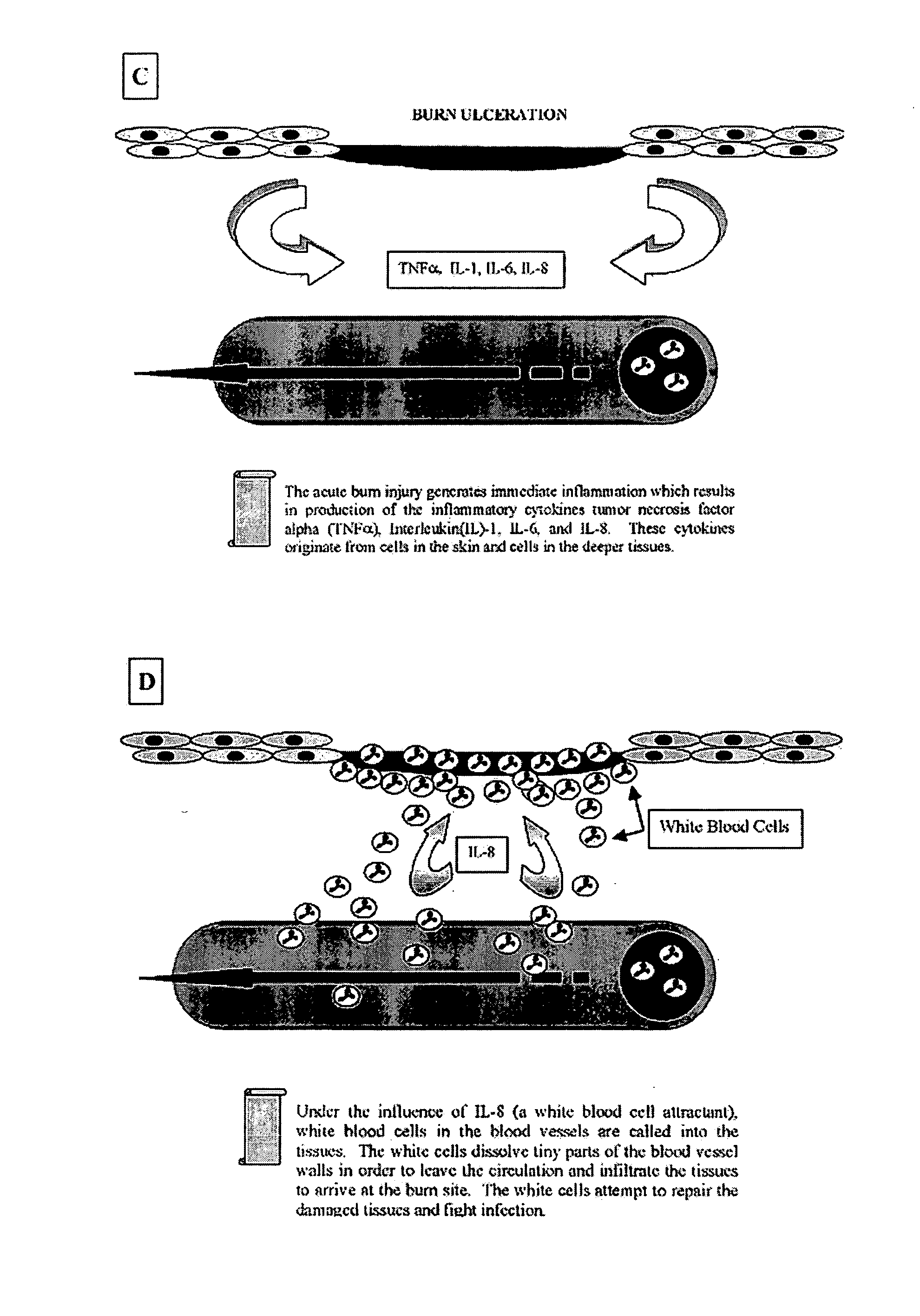 Compositions and methods for treating burns