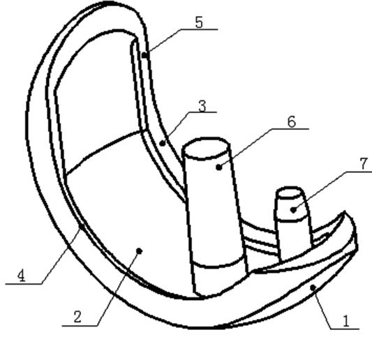 Single-condyle prosthesis matched with posterior condyle of femur