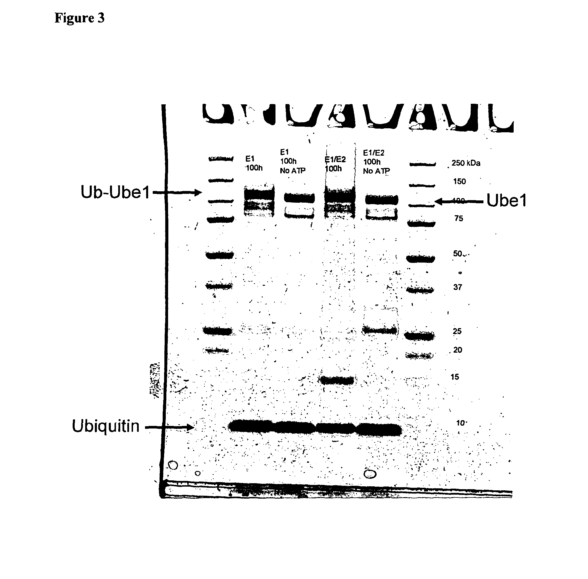 Ubiquitination assay