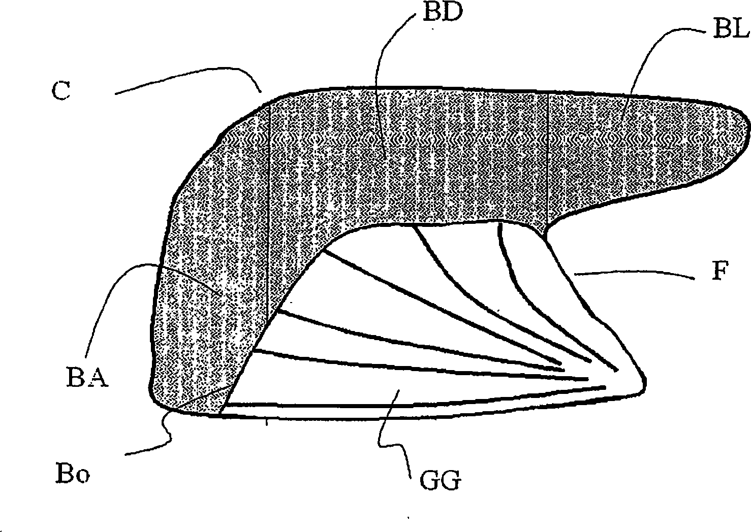 Methods and devices for treating sleep apnea and snoring