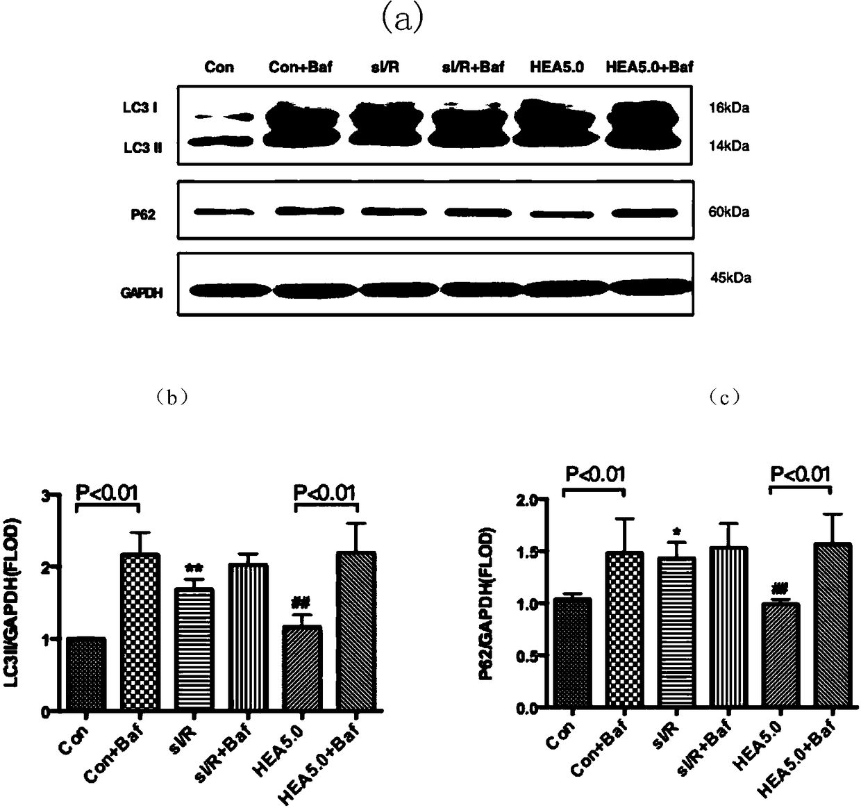 Applications of N6-(2-hydroxyethyl)adenosine in preparation of drugs for prevention or treatment of myocardial ischemic reperfusion injury