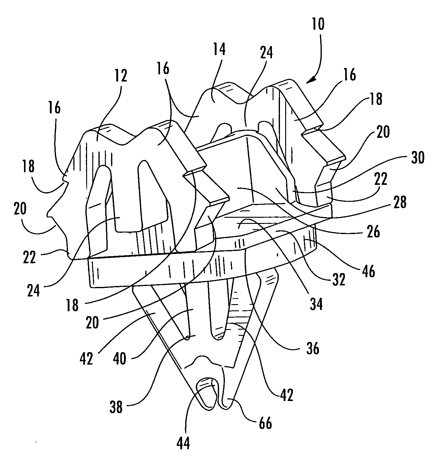 W-base retainer