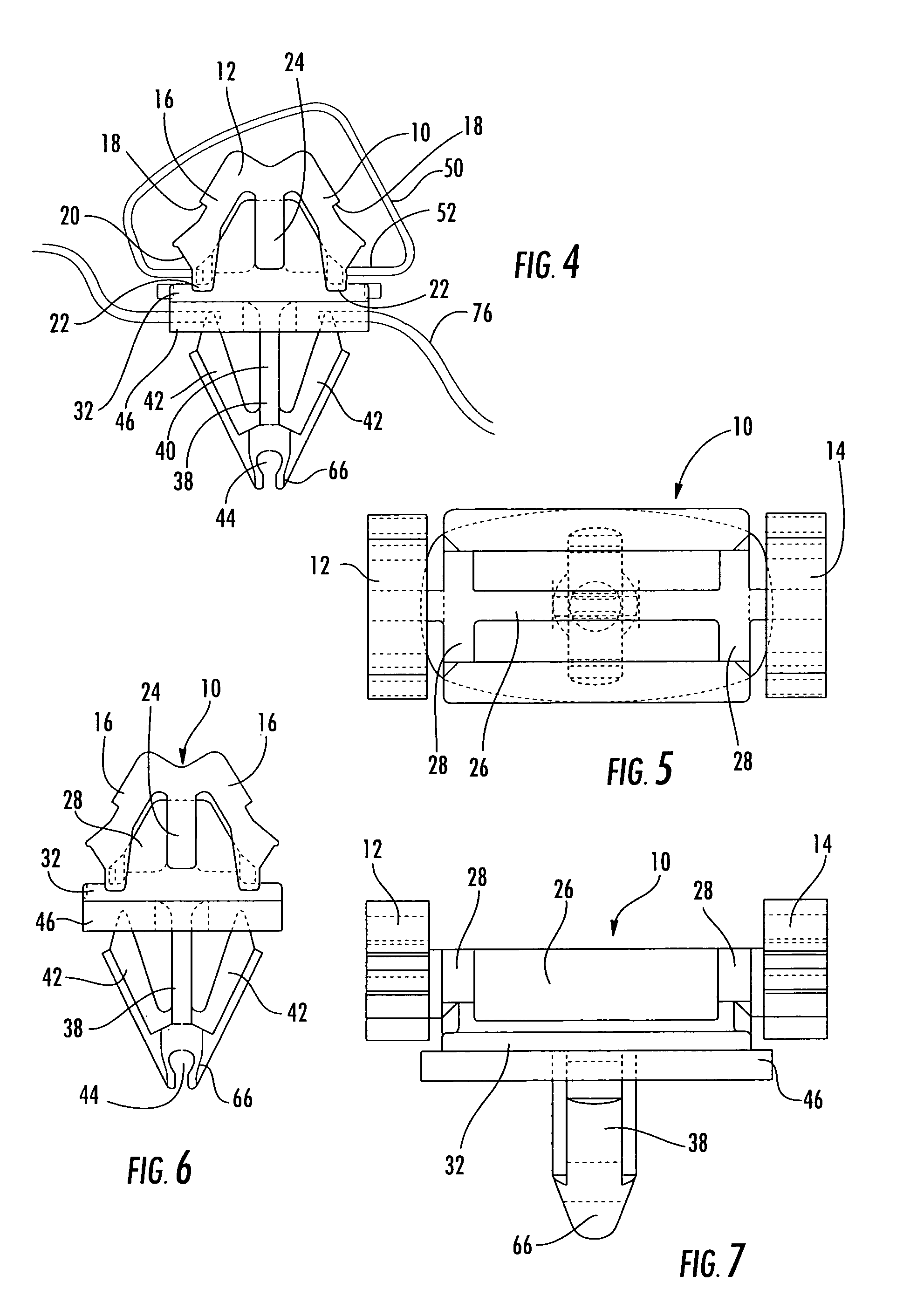 W-base retainer