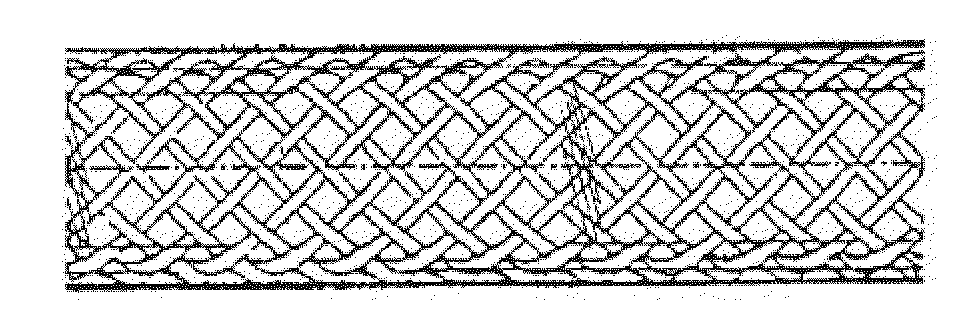 Biodegradable composite wire for medical devices