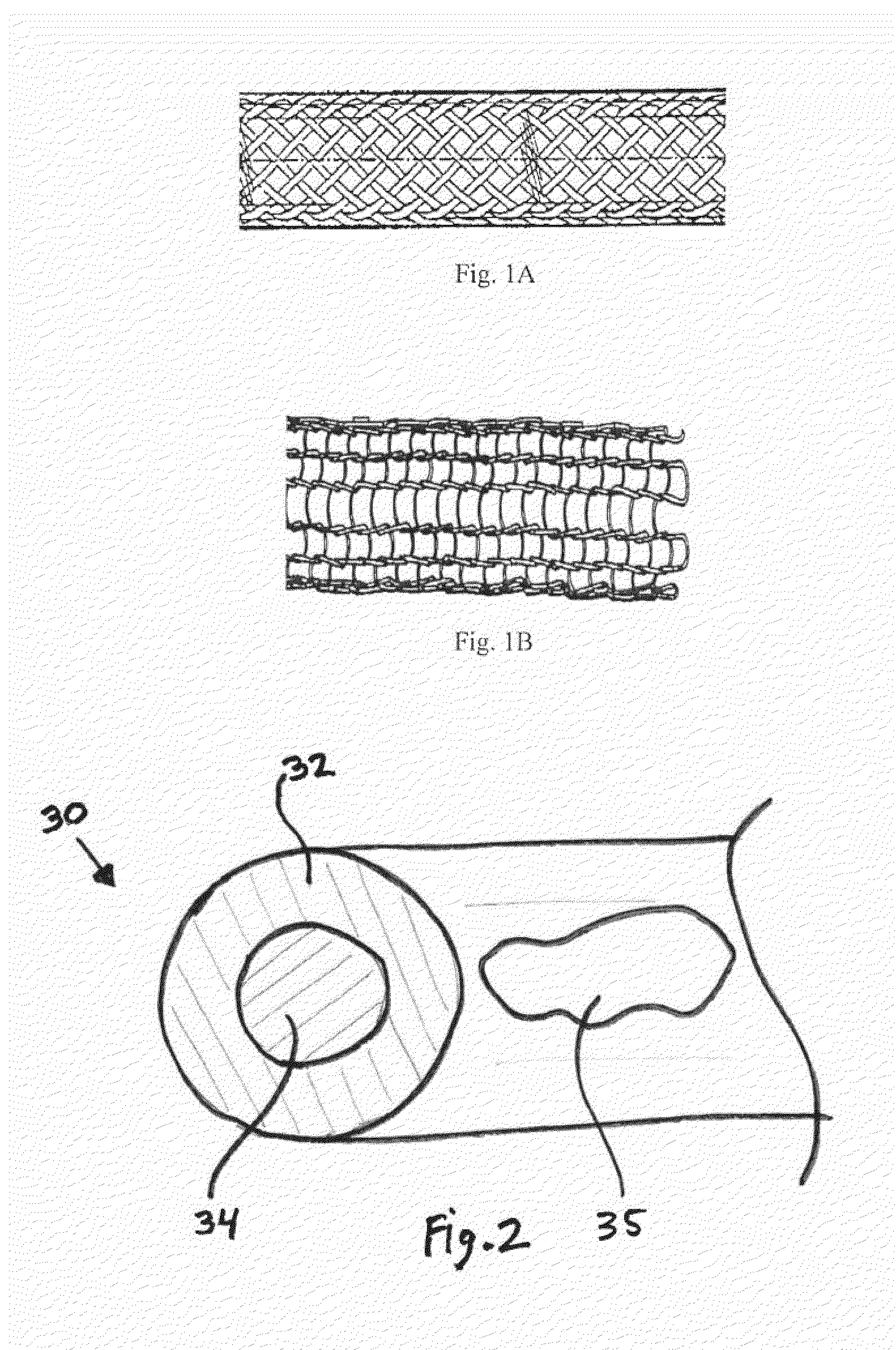 Biodegradable composite wire for medical devices