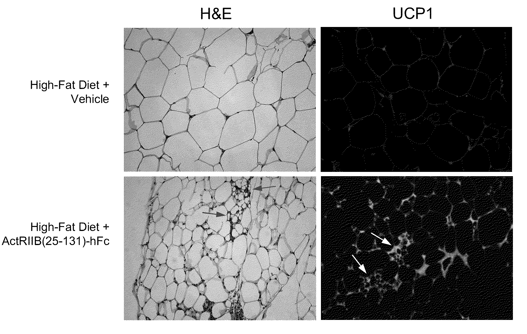 Methods for increasing thermogenic adipocytes