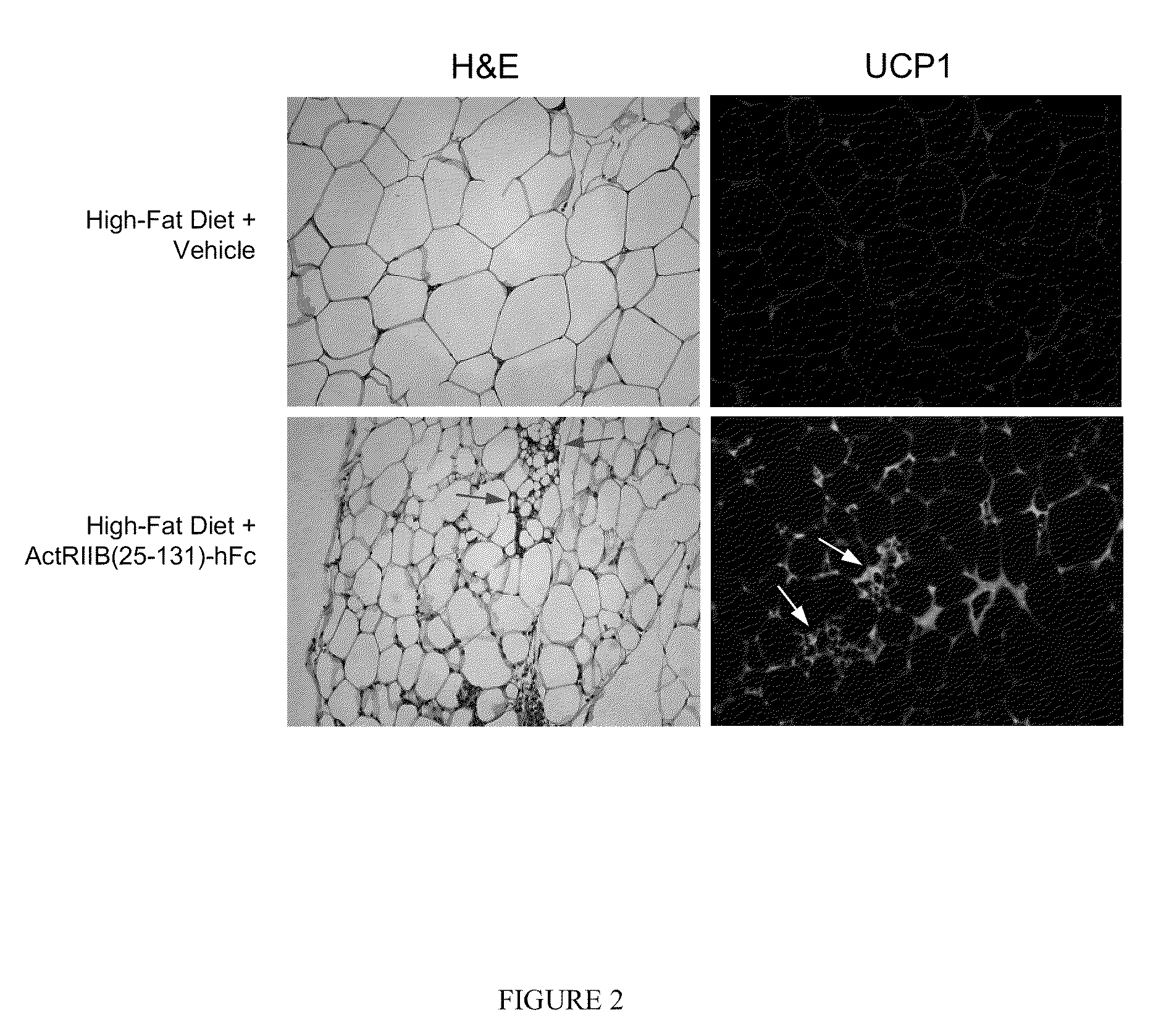 Methods for increasing thermogenic adipocytes