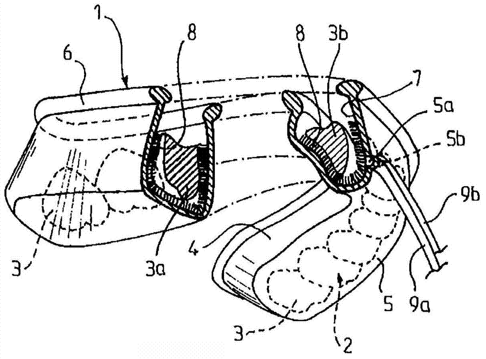 Teeth cleaning device and method