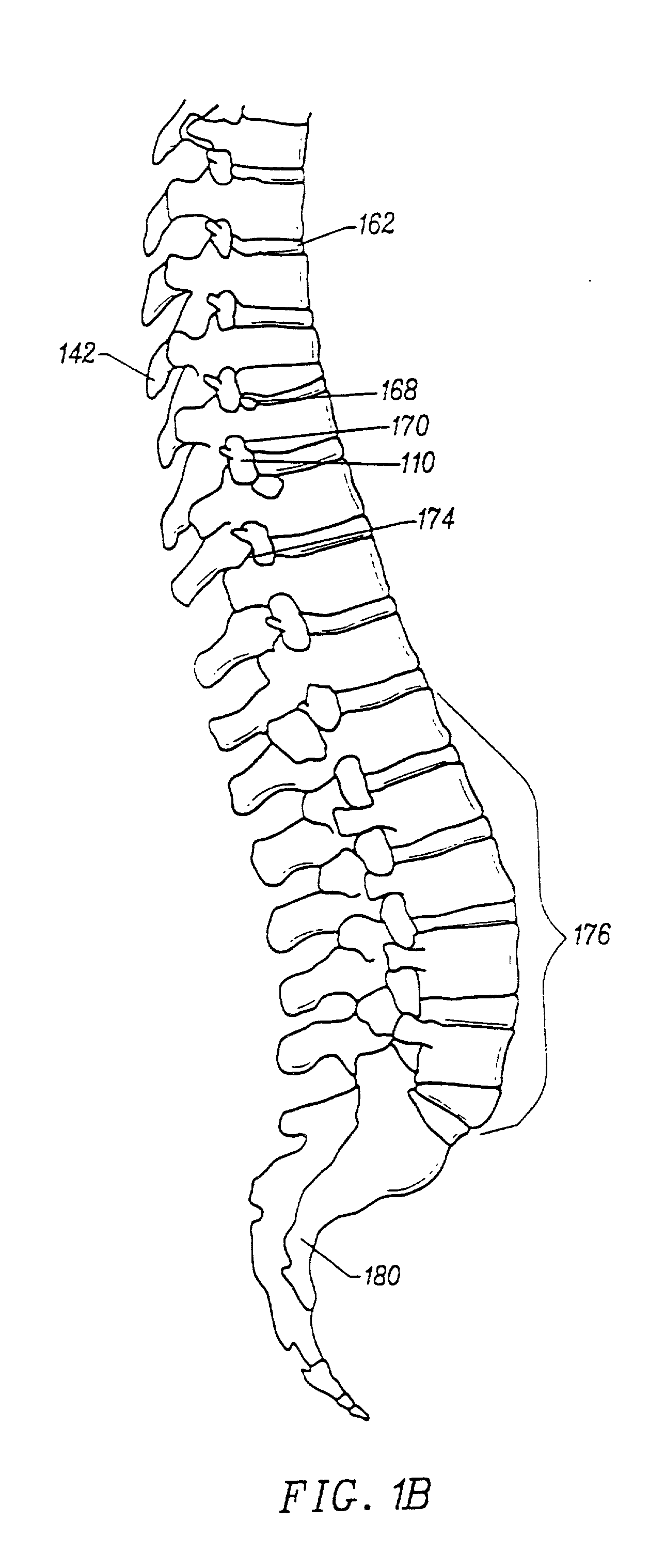 Apparatus and method for accessing and performing a function within an intervertebral disc