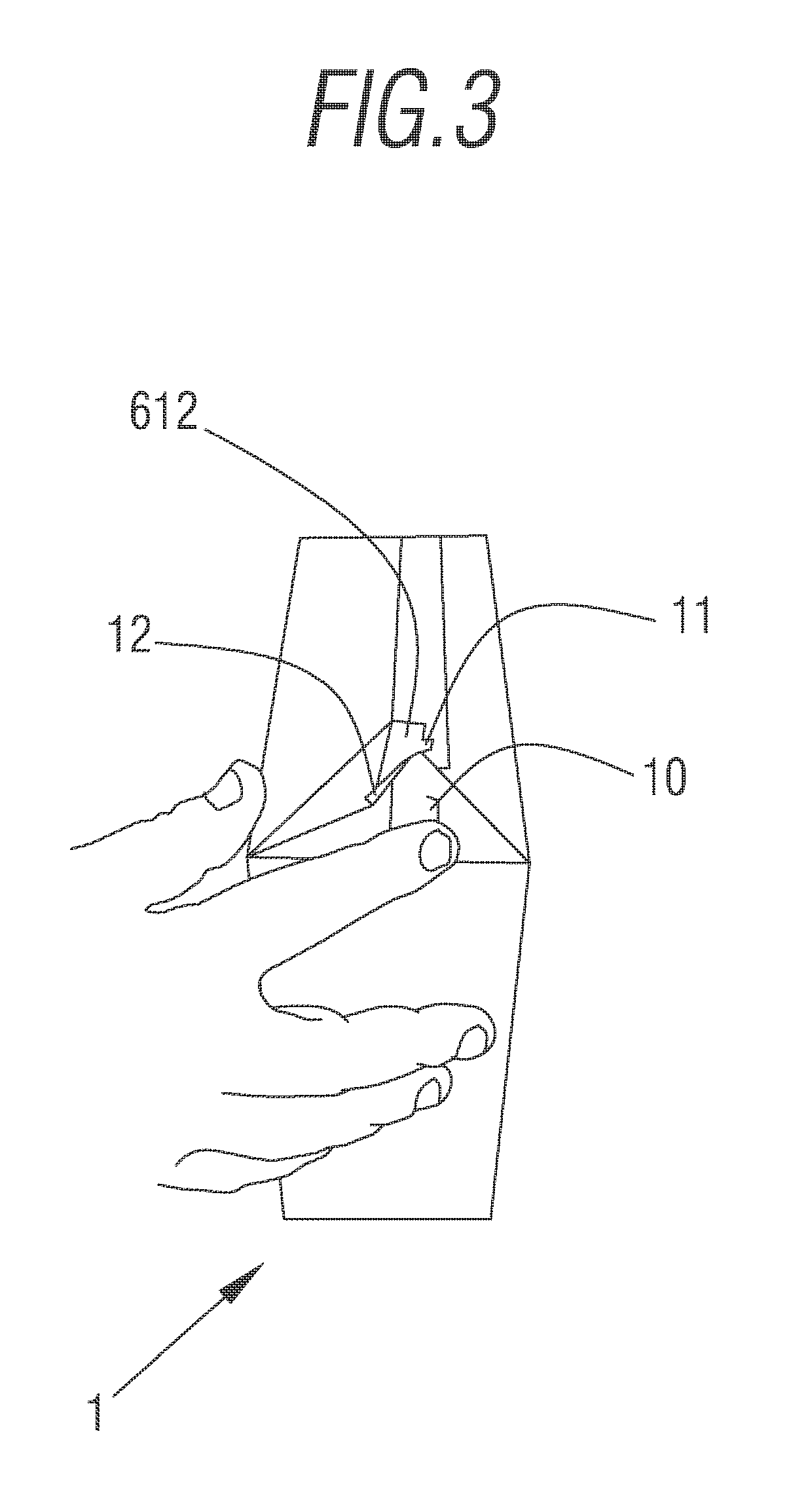 Container with fold-out opening