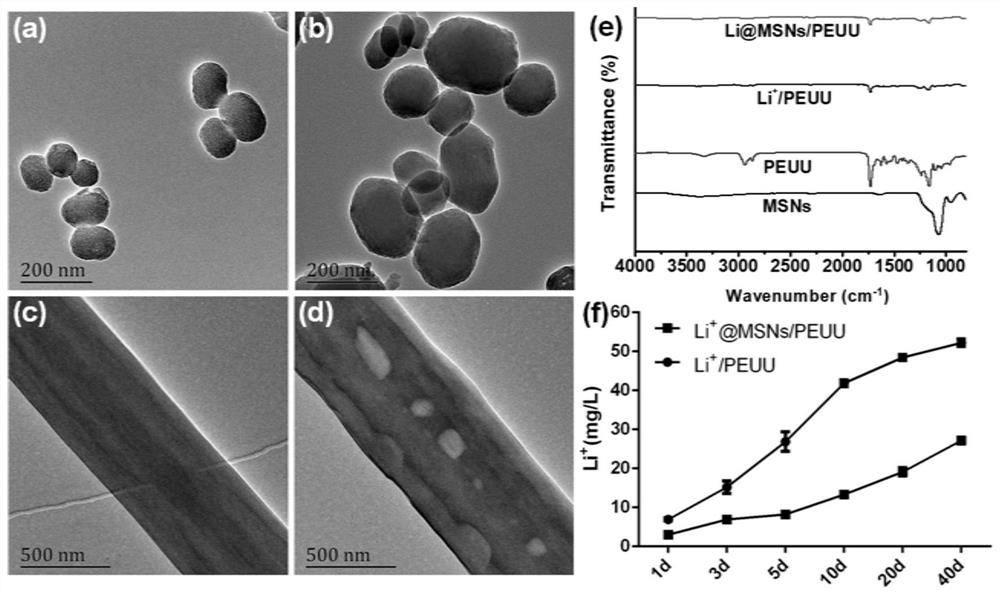 Electrospun membrane stent for promoting rotator cuff tendon bone healing and inhibiting muscle fat infiltration and preparation method thereof