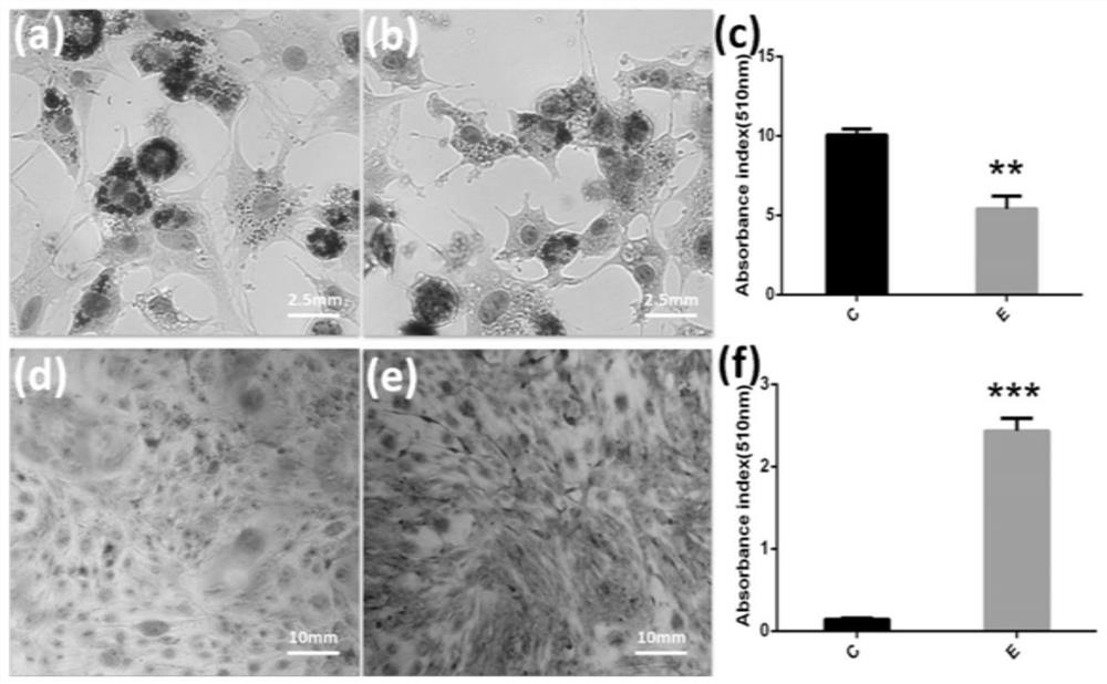 Electrospun membrane stent for promoting rotator cuff tendon bone healing and inhibiting muscle fat infiltration and preparation method thereof