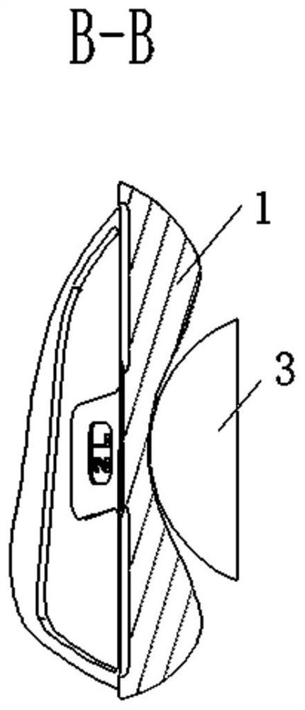 Total knee joint prosthesis