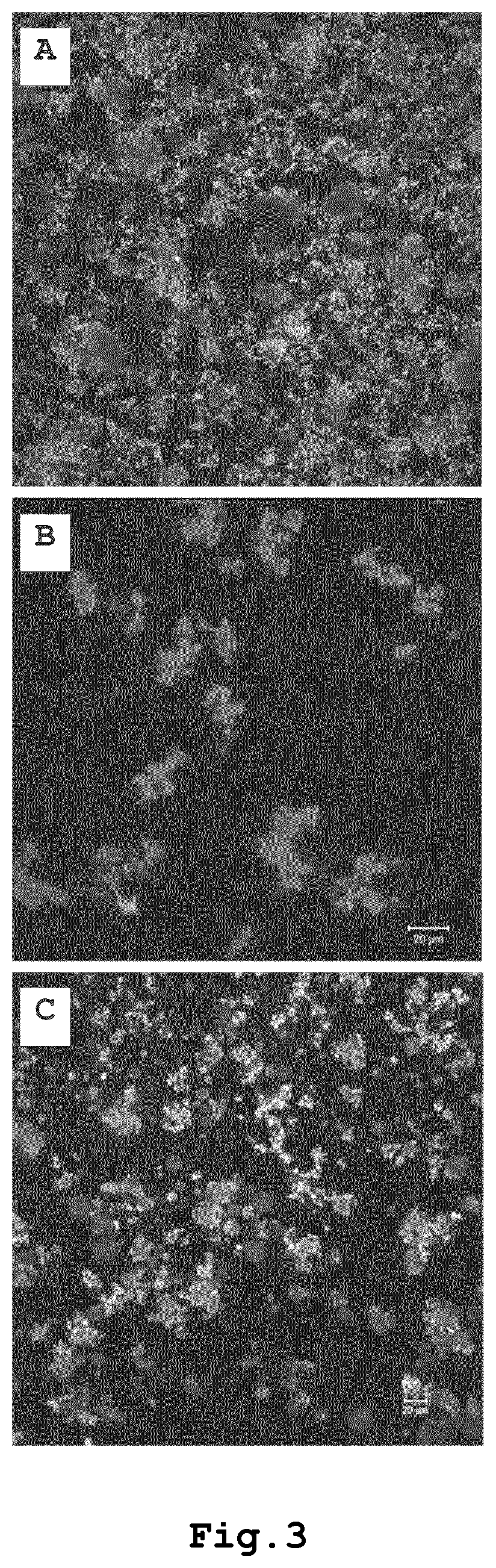 Plant-protein based texturized oil-in-water emulsions