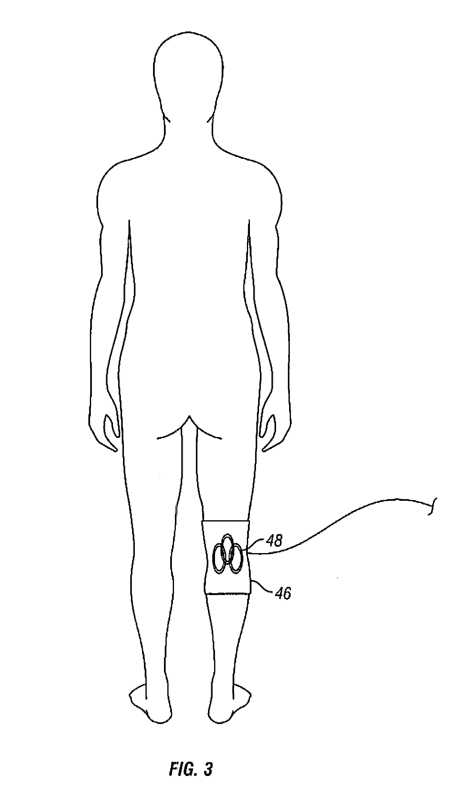 Method and apparatus for magnetic induction therapy