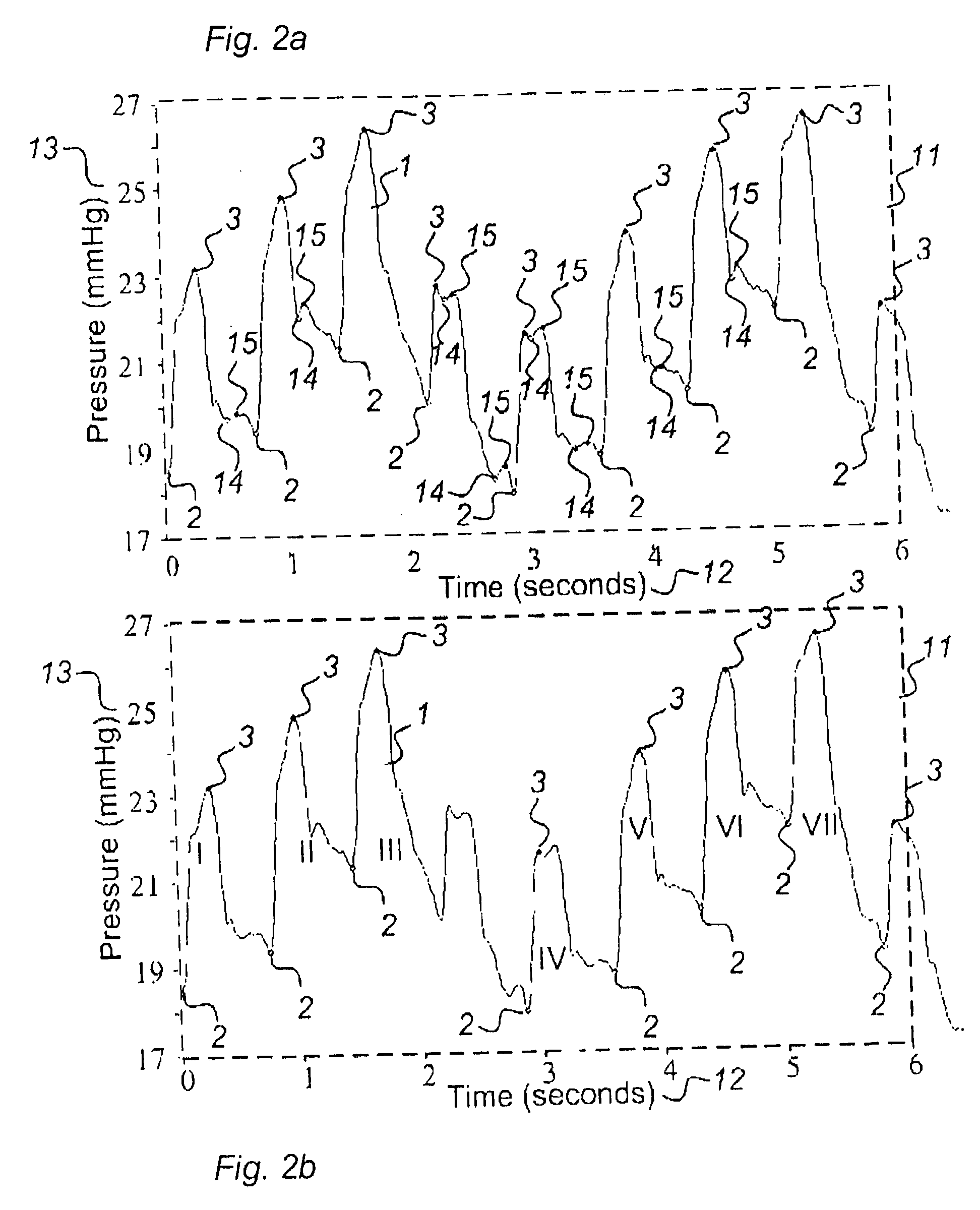 Method for analysis of single pulse pressure waves