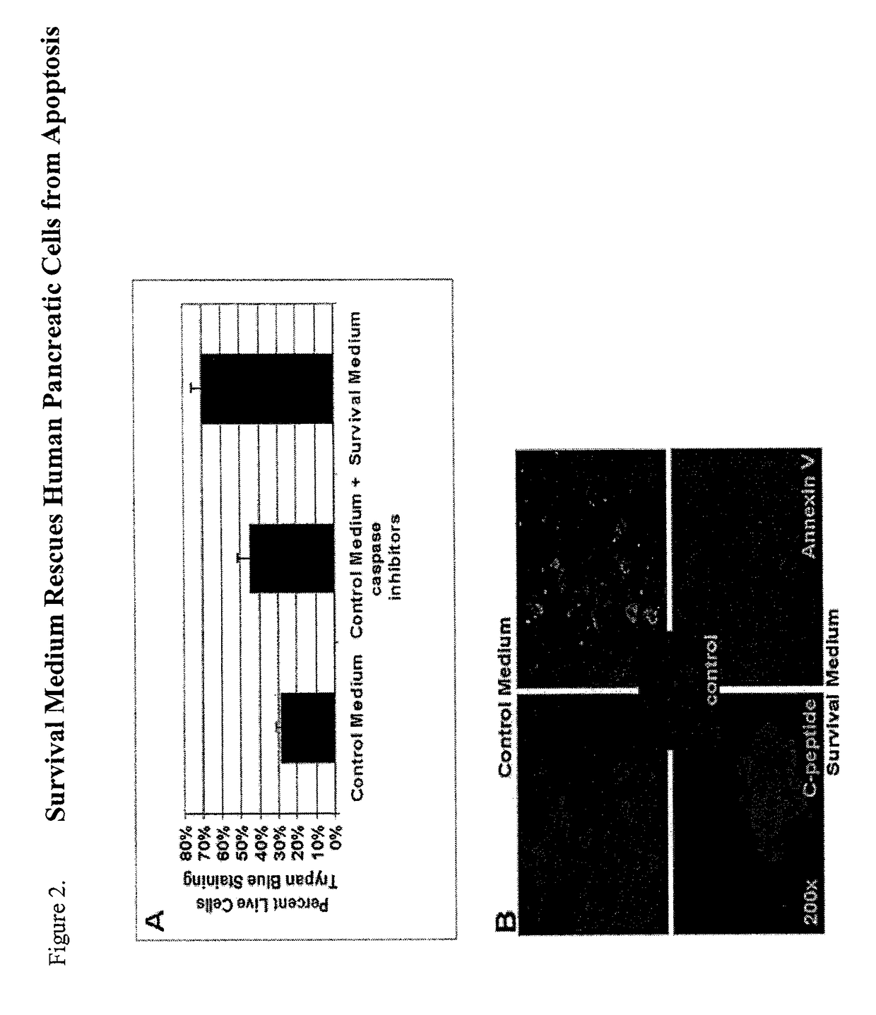 Method of improving cell proliferation of pancreatic progenitor cells in a pancreatic cell culture