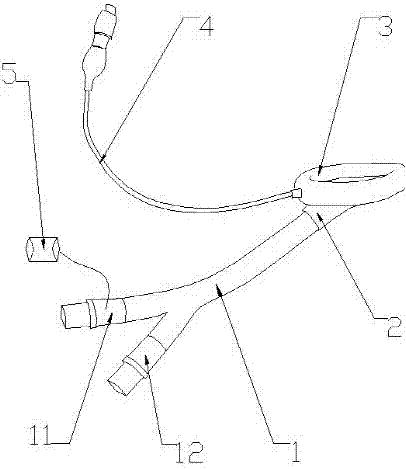 A Y-shaped laryngeal mask with an instrument channel