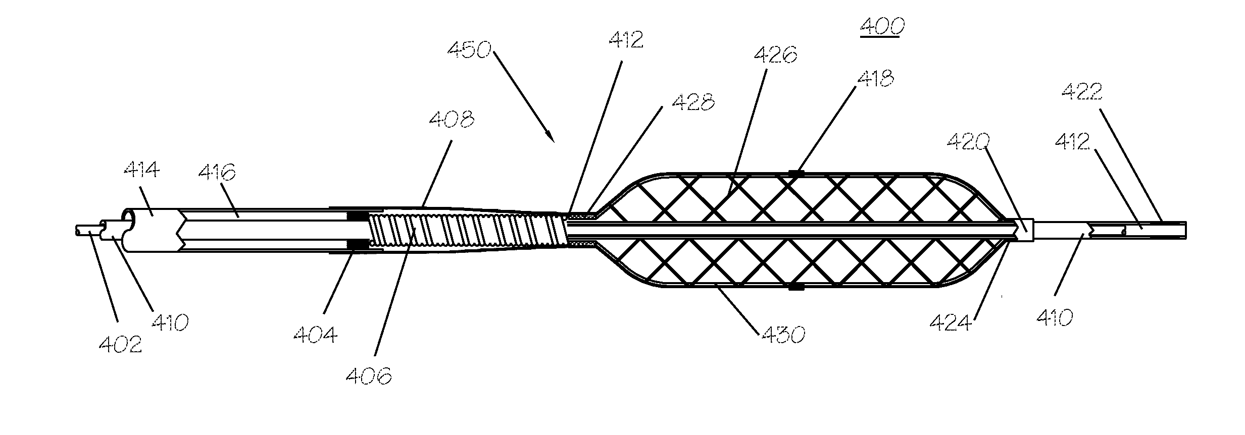 Pressure Activated Foreign Body Removal System and Method of Use