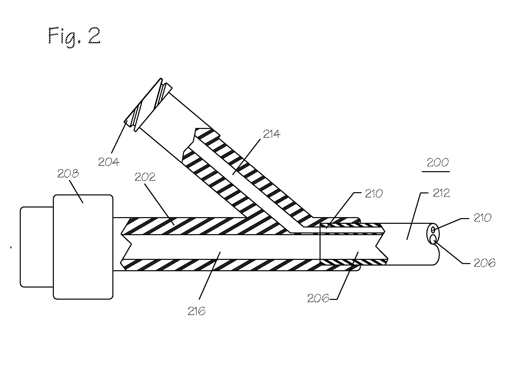 Pressure Activated Foreign Body Removal System and Method of Use