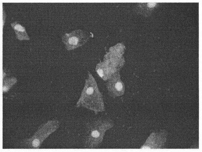 Stable and easy-to-store vaginal secretion microbial cell fluorescence detection dye liquor