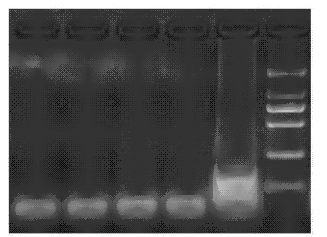 CyHV-2 (Cyprinid herpesvirus II) LAMP (loop-mediated isothermal amplification) detection kit and detection method