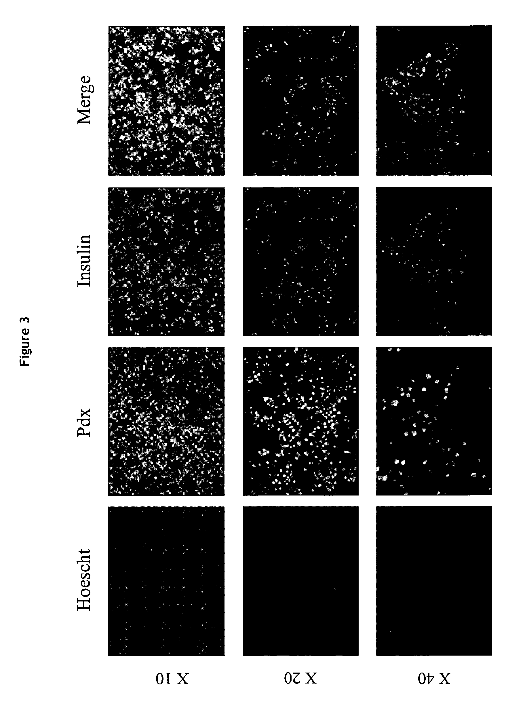 Production of a human beta cell line from an early post natal pancreas