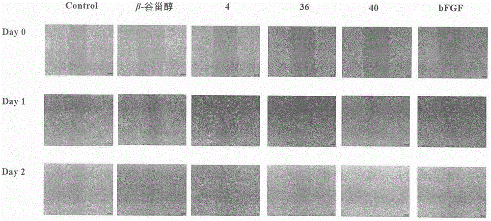 Sterol derivative, and preparation method and application thereof