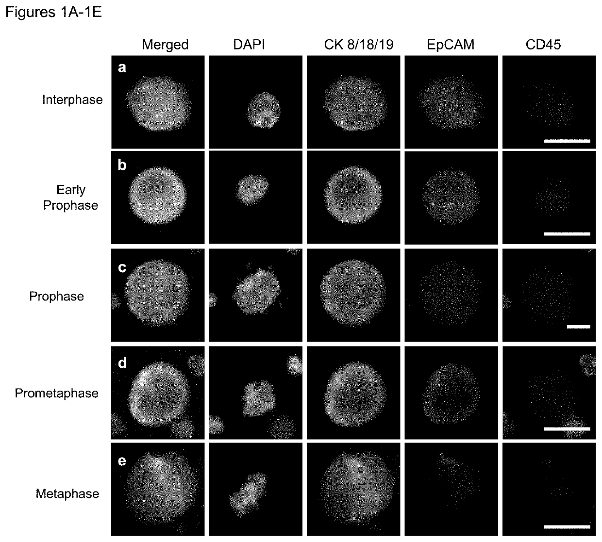 Use of circulating tumor cell mitotic index in cancer stratification and diagnostics