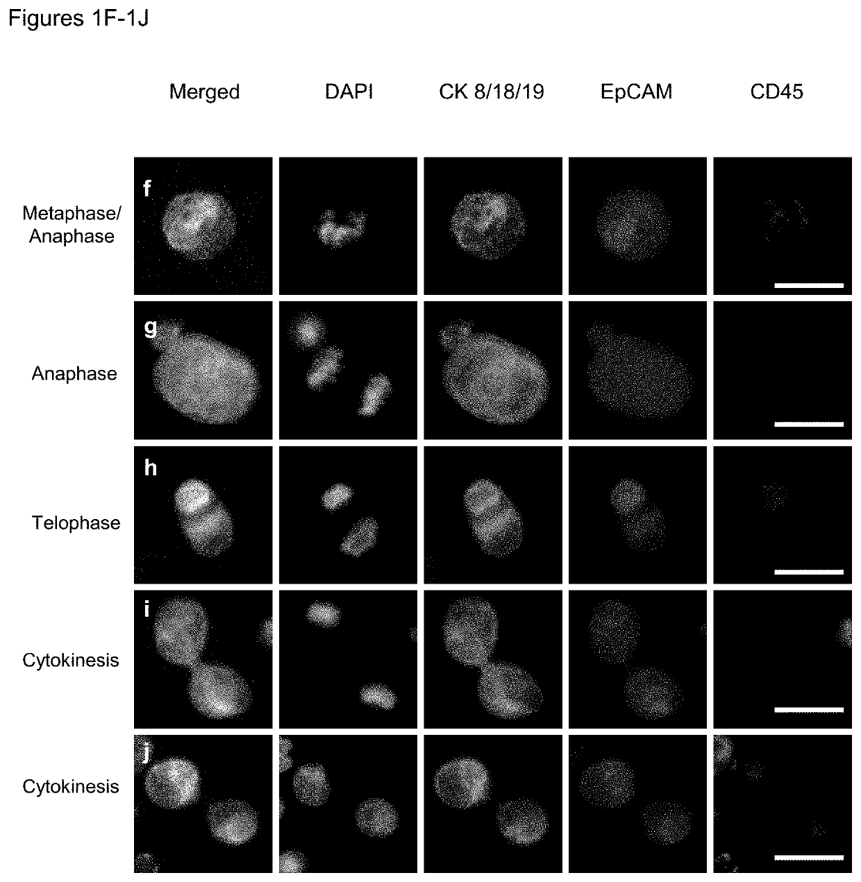 Use of circulating tumor cell mitotic index in cancer stratification and diagnostics