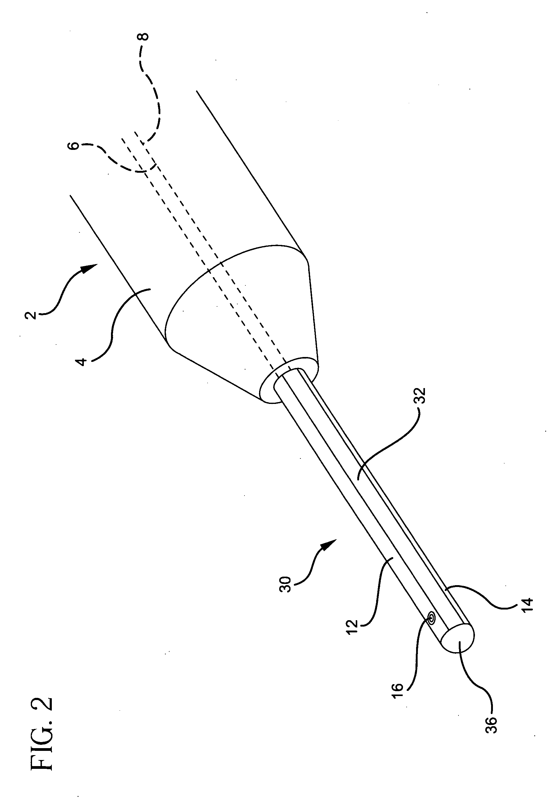 Tubal sterilization device having expanding electrodes and method for performing sterilization using the same